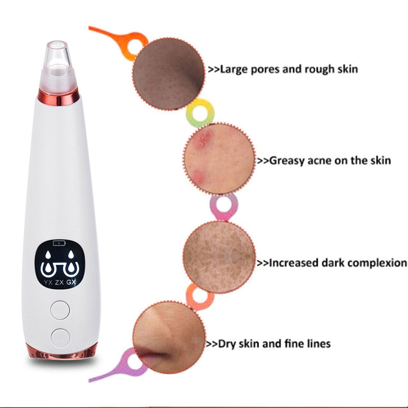 BLACKHEAD SUCKER