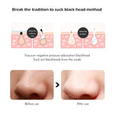 BLACKHEAD SUCKER